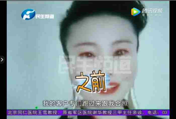 整容失败案例（女子整容失败崩溃大哭）