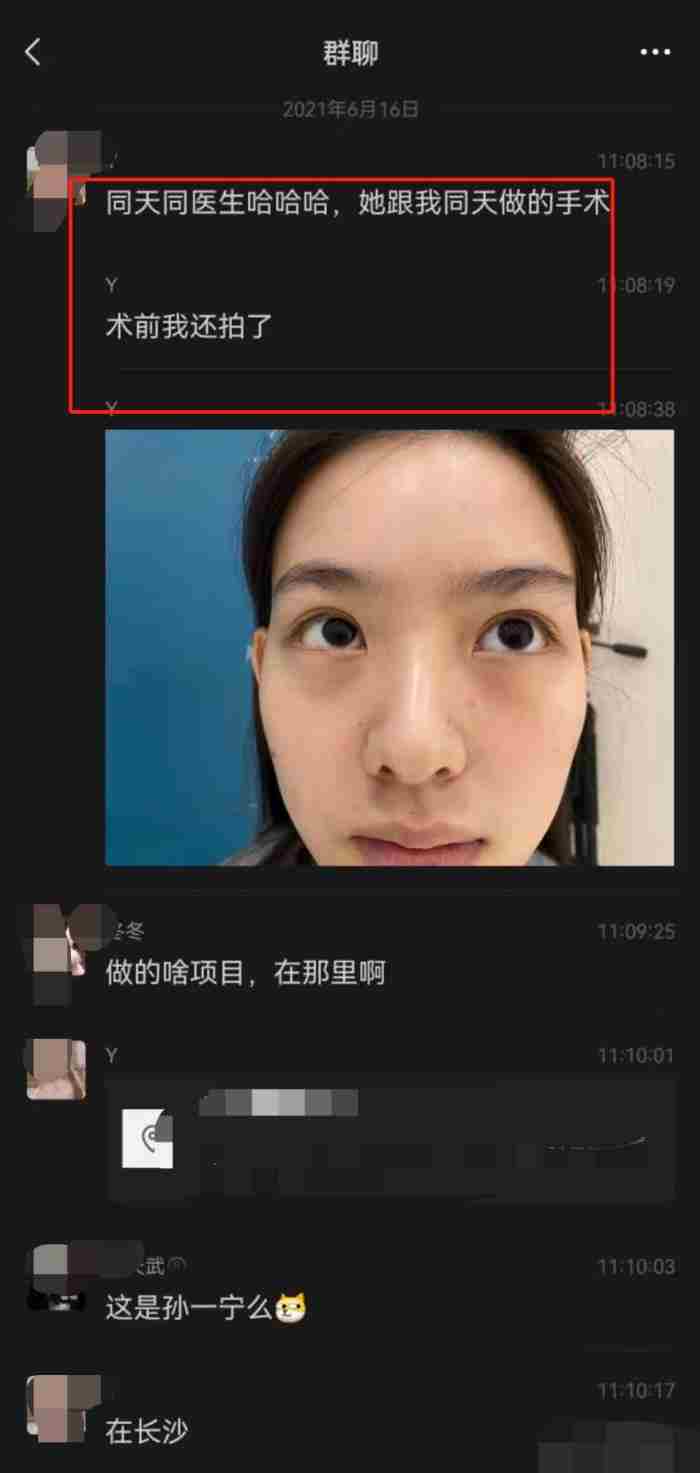 整形案例 微整前后对比照图片