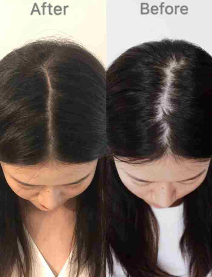 防脱发洗发水哪个牌子好 脱发掉发用什么洗发水好