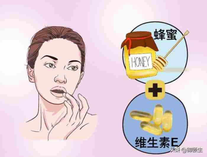 嘴唇干裂脱皮怎么办 下嘴唇干裂怎么办