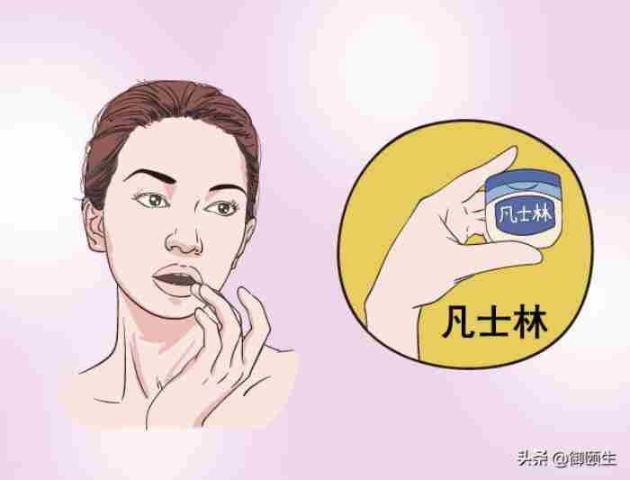 嘴唇干裂脱皮怎么办 下嘴唇干裂怎么办