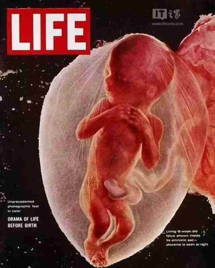 精子是如何变成婴儿的?人类诞生的全过程